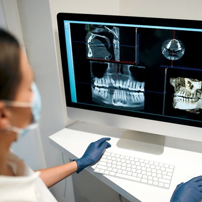 Une femme médecin regarde des radios de la mâchoire sur un écran d’ordinateur