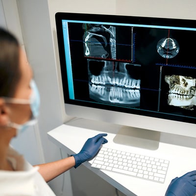 Une femme médecin regarde des radios de la mâchoire sur un écran d’ordinateur